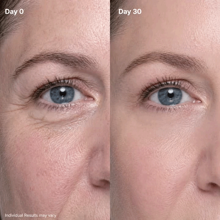 ⏳ LAST 30 MINUTES! 🔥 Get 50% OFF Clinclii P7 Eye Cream Before This Deal Ends! ✨